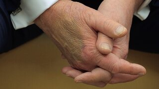 Ľudí zaujala podozrivá modrina na Trumpovej ruke. Biely dom prišiel s prekvapivým vysvetlením 