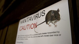 Čo je hantavírus, ktorý usmrtil manželku herca Gena Hackmana? Neexistuje naň liečba, pôsobí ako chrípka