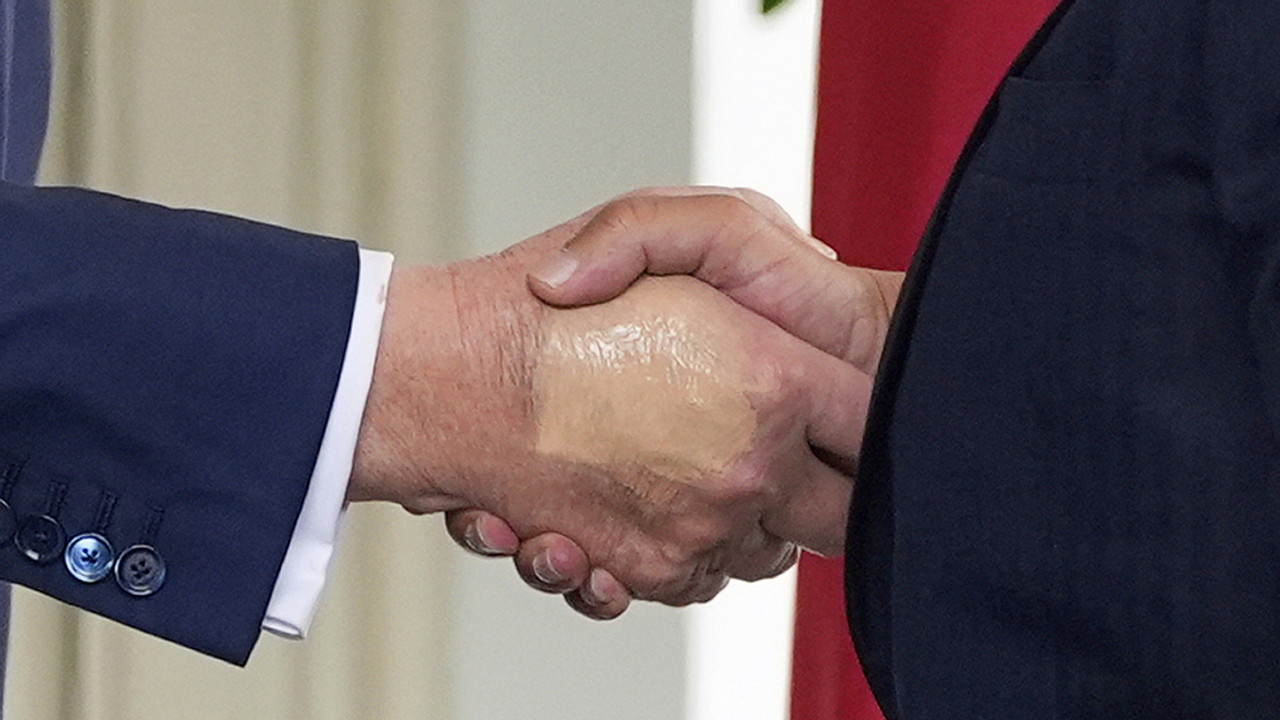 mejkap na ruke Trump diagnóza