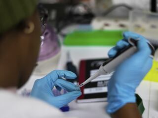 HIV