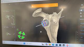 MUDr. Mesiarik pri operácii (3).jpeg