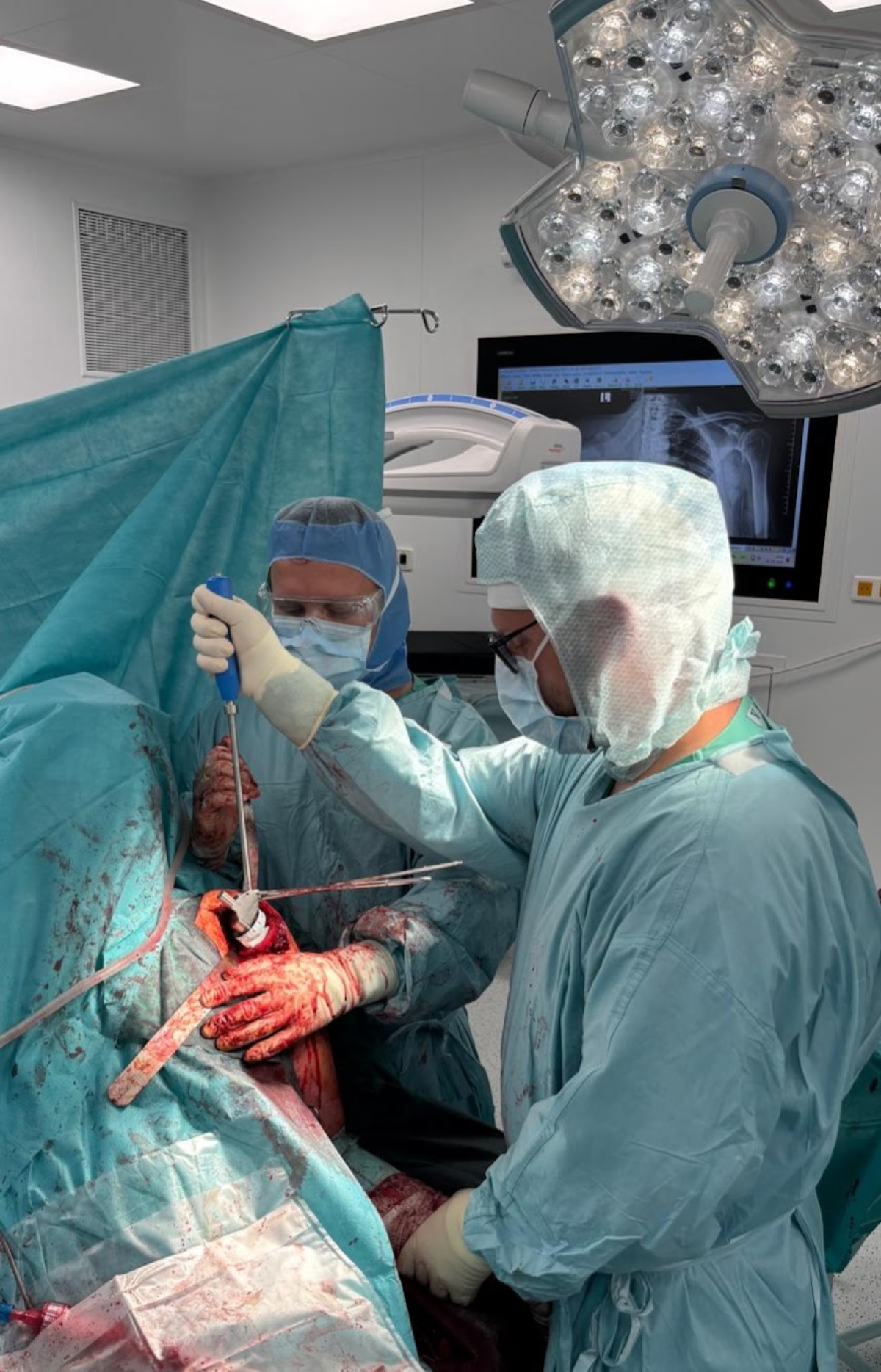 MUDr. Mesiarik pri operácii (4).jpeg