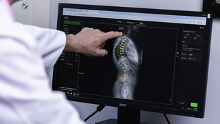 chrbtica lekár snímka kostra