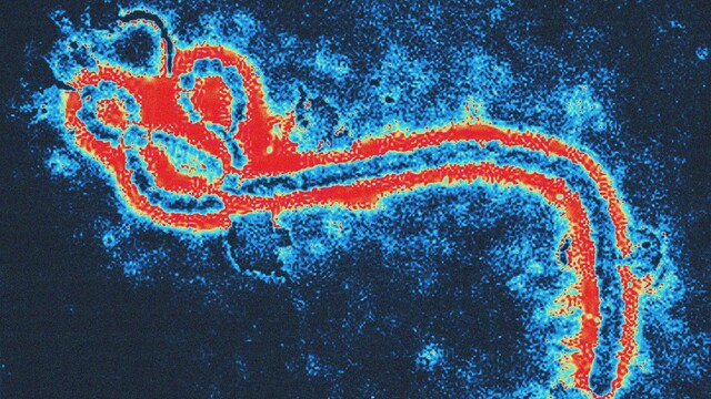 Ebola, vírus
