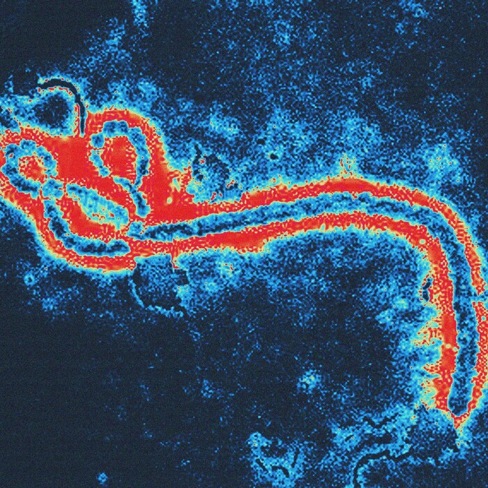 Ebola, vírus