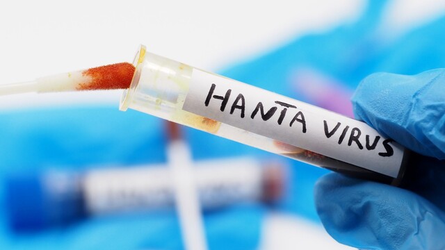 hantavirus