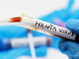 hantavirus