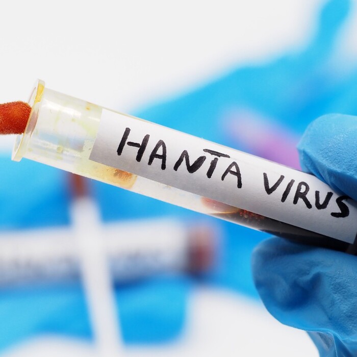 hantavirus