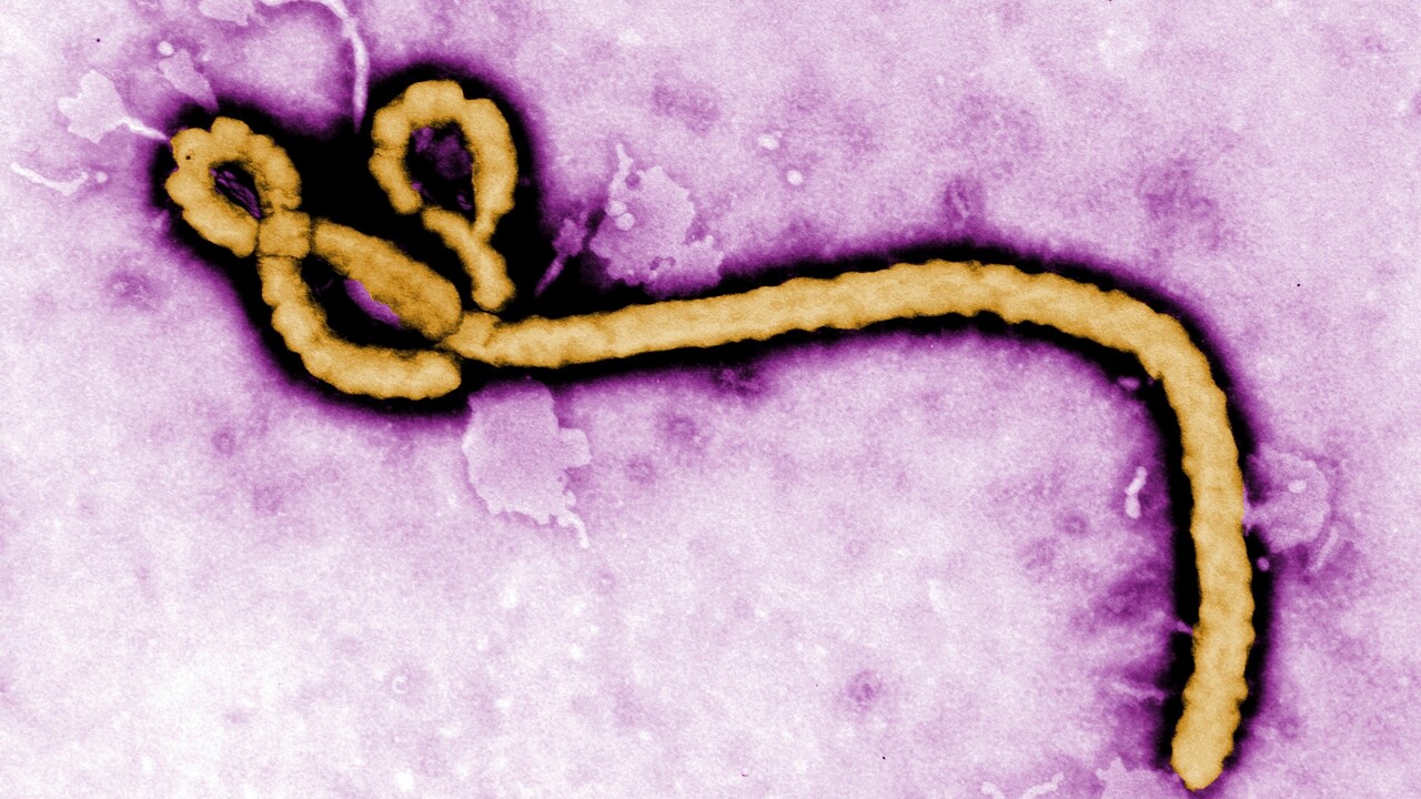 Ebola vírus