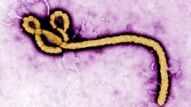 Ebola vírus