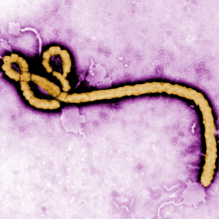 Ebola vírus