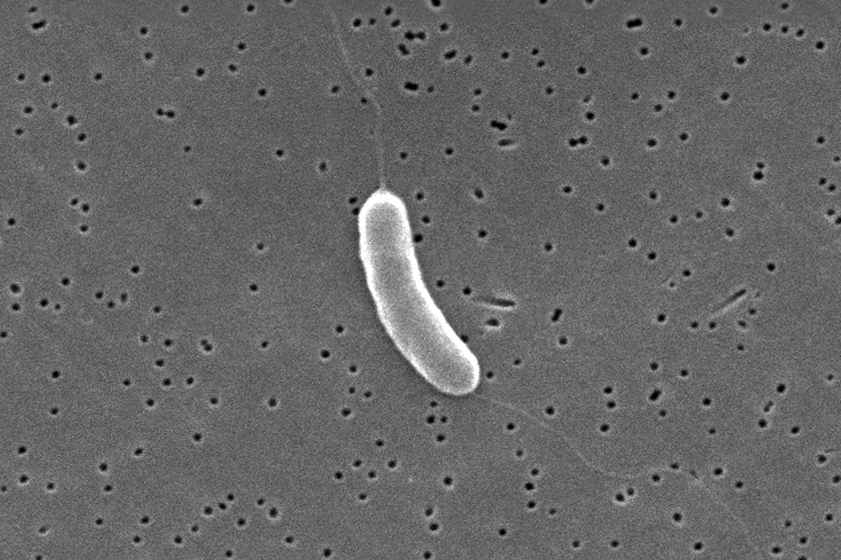 baktéria Vibrio vulnificus.