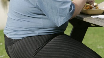 Obezita a vyššie BMI súvisia s priebehom covidu, ukázala štúdia