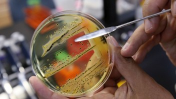 Vedci skúmali vplyv vyšších dávok antibiotík na odolnosť baktérií