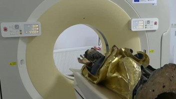 Neobvyklí pacienti pod röntgenom. V nemocnici diagnostikovali sochy