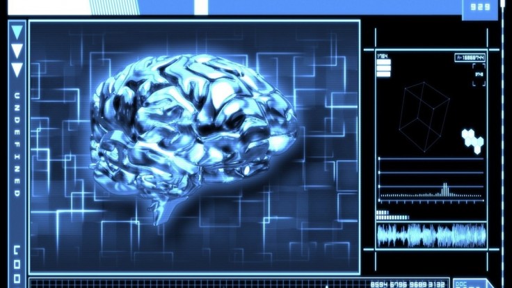 Prelomový systém? Umelá inteligencia môže pomôcť odhaliť demenciu z jedinej snímky mozgu