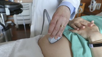 Pre riziko koronavírusu vyzvali ženy, aby odložili tehotenstvo