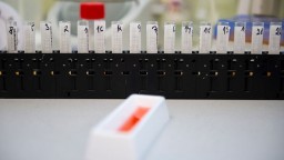 Vo Francúzsku sa objavil nový variant koronavírusu, testy ho odhalili u 12 osôb