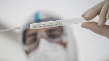 Omikron a chrípka majú veľmi podobné príznaky, spoľahlivo ich odlíši len PCR test