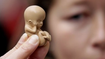 Počet potratov na Slovensku naďalej klesá, momentálne je na historickom minime