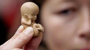 So zrušením ústavného práva na potrat súhlasí 41 percent Američanov, vyplýva z prieskumu