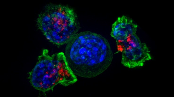 Duálna terapia nabíja bunky na ničenie metastázujúcej rakoviny prsníka