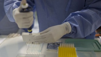 Vedci chcú, aby vírus HIV bojoval sám proti sebe