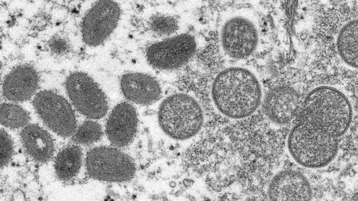 Vírusové častice opičích kiahní na snímke z mikroskopu z roku 2003.